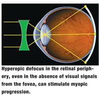 Myopia Control