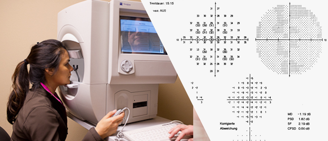 Периметрия в офтальмологии. Компьютерная статическая периметрия. Поля зрения компьютерная периметрия. Компьютерная периметрия Хамфри. Статическая периметрия глаза.